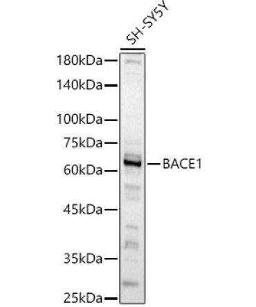 BACE1 Rabbit Polyclonal Antibody