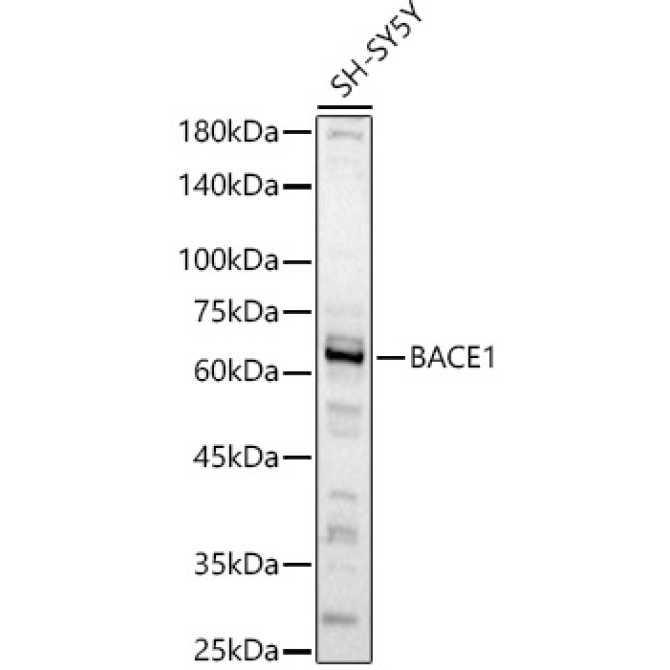 BACE1 Rabbit Polyclonal Antibody