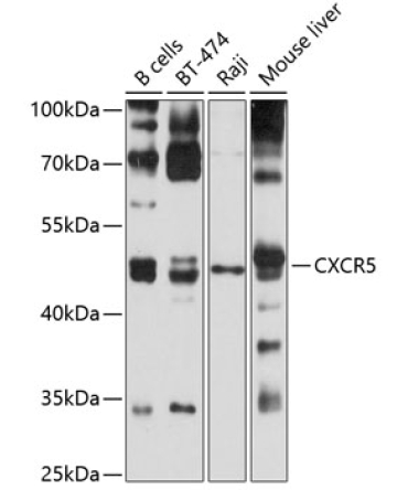 CXCR5 Rabbit Polyclonal Antibody