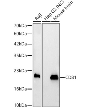 CD81 Rabbit Polyclonal Antibody
