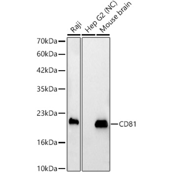 CD81 Rabbit Polyclonal Antibody