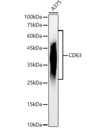 CD63 Rabbit Polyclonal Antibody
