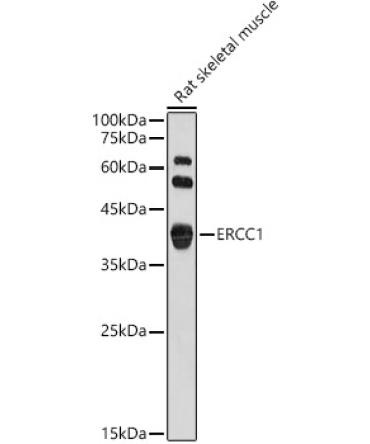 ERCC1 Rabbit Polyclonal Antibody