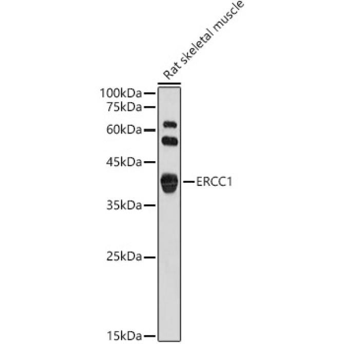 ERCC1 Rabbit Polyclonal Antibody