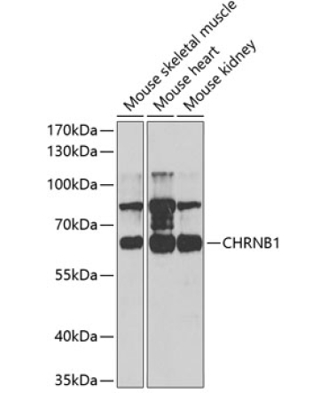 CHRNB1 Rabbit Polyclonal Antibody