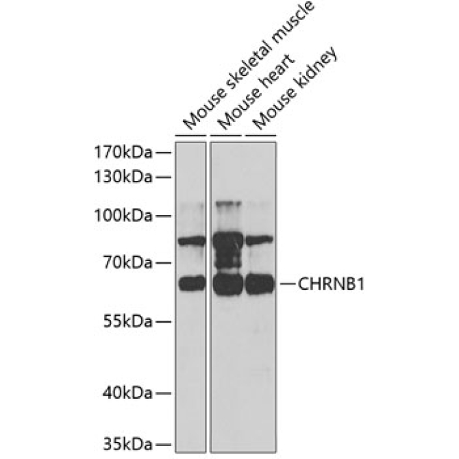 CHRNB1 Rabbit Polyclonal Antibody