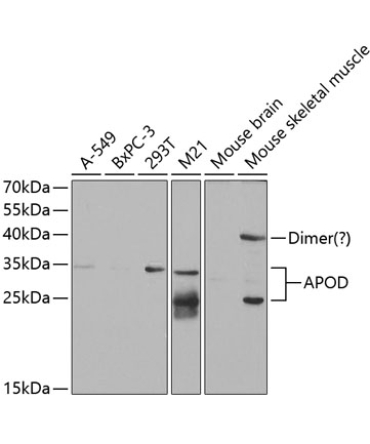APOD Rabbit Polyclonal Antibody
