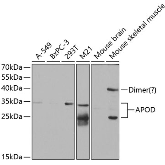 APOD Rabbit Polyclonal Antibody