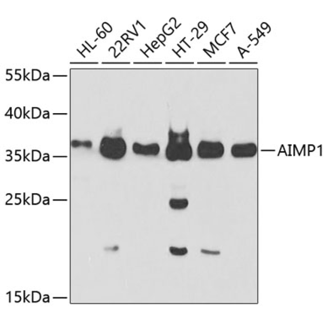 AIMP1 Rabbit Polyclonal Antibody