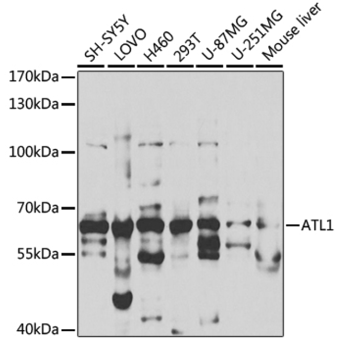 ATL1 Rabbit Polyclonal Antibody
