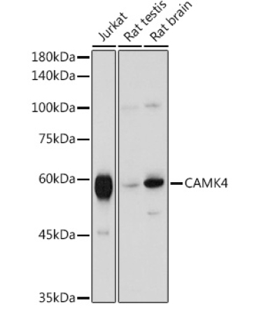 CAMK4 Rabbit Polyclonal Antibody