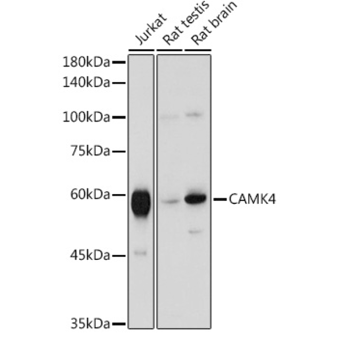 CAMK4 Rabbit Polyclonal Antibody