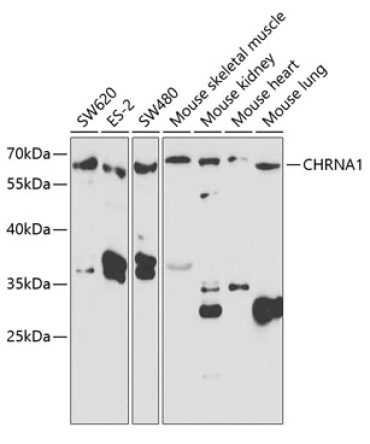 CHRNA1 Rabbit Polyclonal Antibody