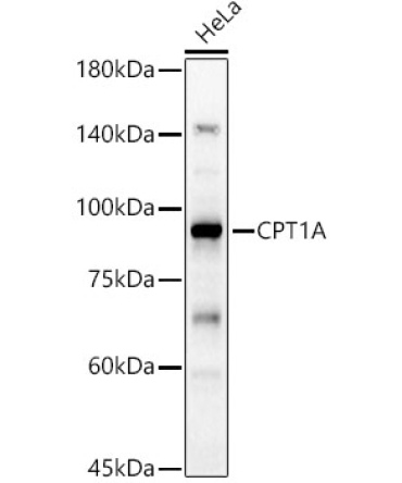 CPT1A Rabbit Polyclonal Antibody