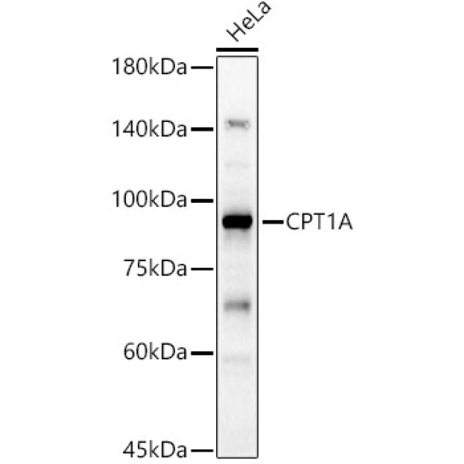 CPT1A Rabbit Polyclonal Antibody