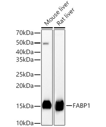 FABP1 Rabbit Polyclonal Antibody