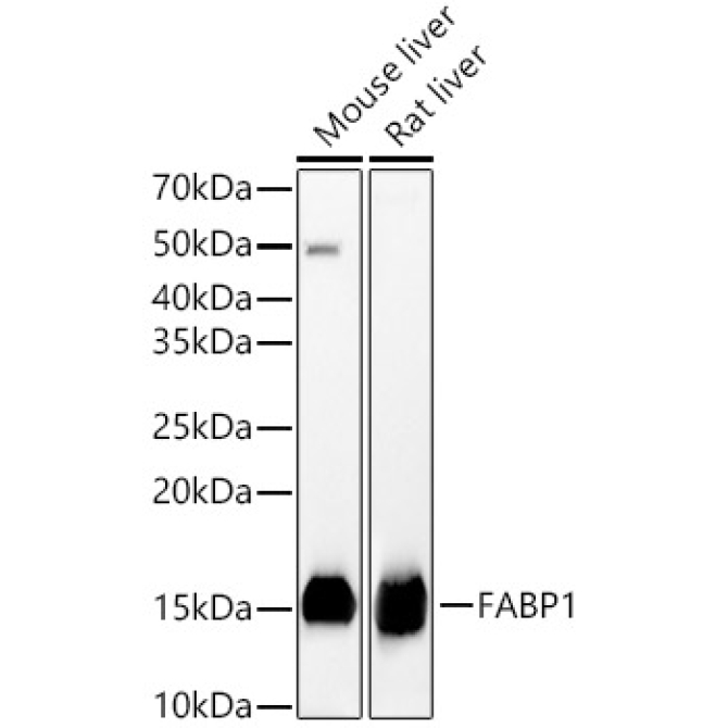 FABP1 Rabbit Polyclonal Antibody