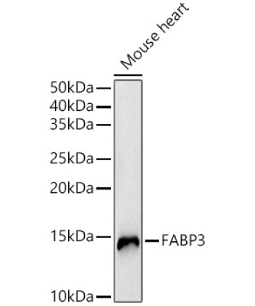 FABP3 Rabbit Polyclonal Antibody