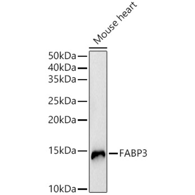 FABP3 Rabbit Polyclonal Antibody