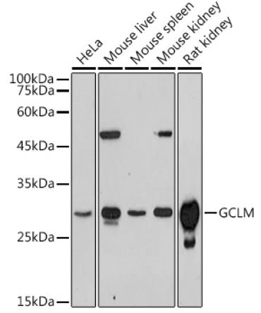 GCLM Rabbit Polyclonal Antibody