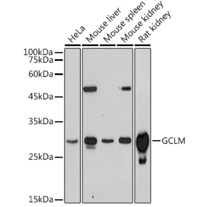 GCLM Rabbit Polyclonal Antibody
