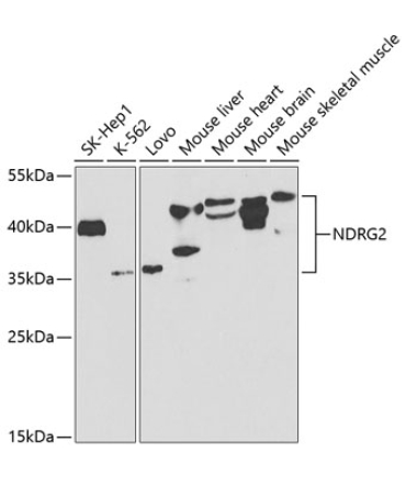 NDRG2 Rabbit Polyclonal Antibody
