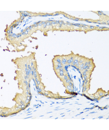 NOV Rabbit Polyclonal Antibody