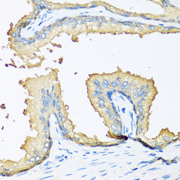NOV Rabbit Polyclonal Antibody