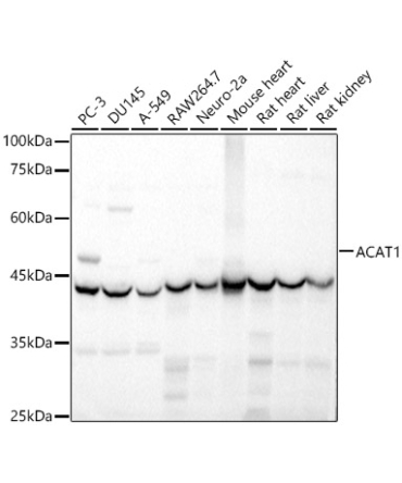 ACAT1 Rabbit Polyclonal Antibody