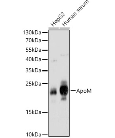 ApoM Rabbit Polyclonal Antibody