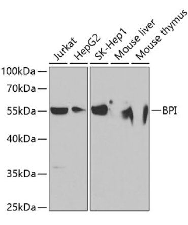 BPI Rabbit Polyclonal Antibody