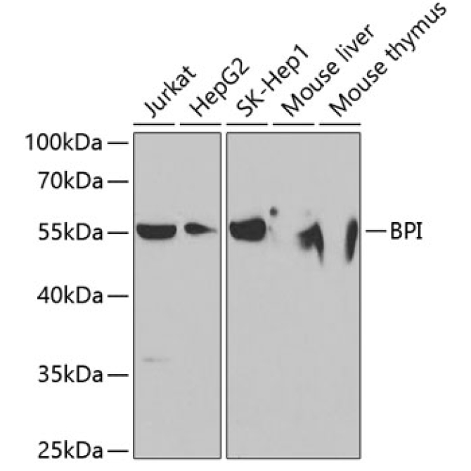 BPI Rabbit Polyclonal Antibody