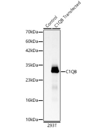 C1QB Rabbit Polyclonal Antibody