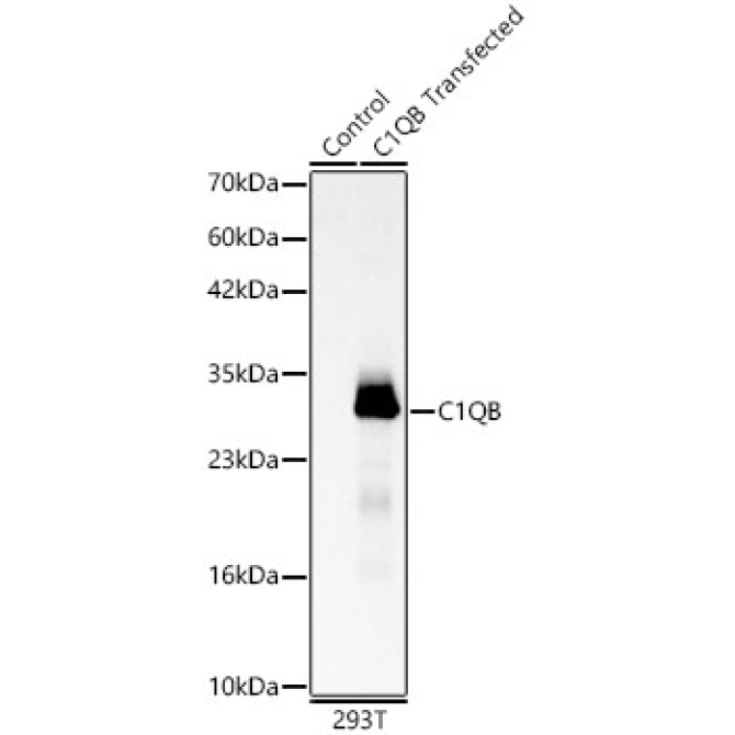 C1QB Rabbit Polyclonal Antibody