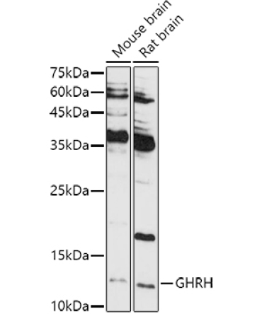 GHRH Rabbit Polyclonal Antibody
