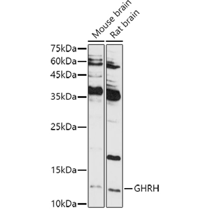 GHRH Rabbit Polyclonal Antibody