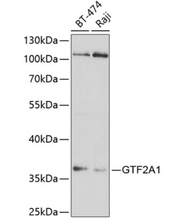 GTF2A1 Rabbit Polyclonal Antibody