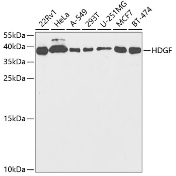 HDGF Rabbit Polyclonal Antibody