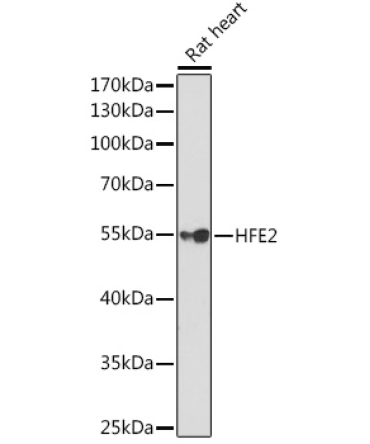 HFE2 Rabbit Polyclonal Antibody