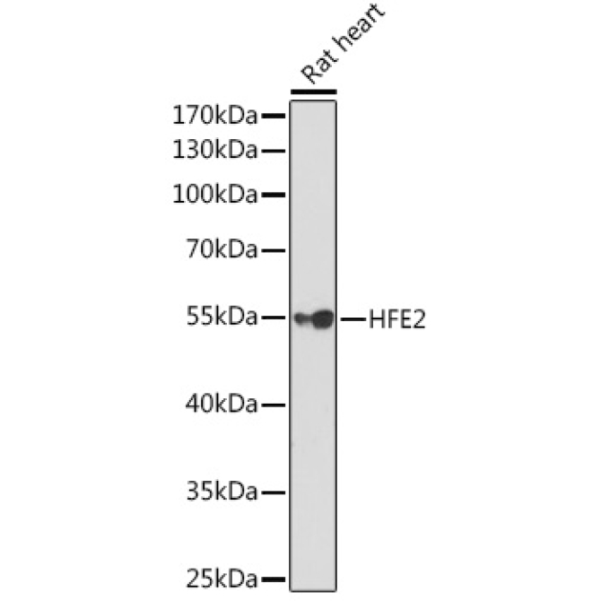 HFE2 Rabbit Polyclonal Antibody