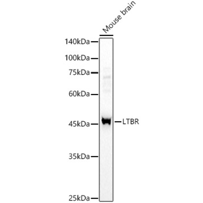 LTBR Rabbit Polyclonal Antibody