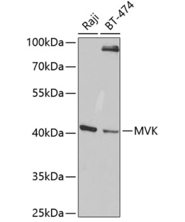 MVK Rabbit Polyclonal Antibody