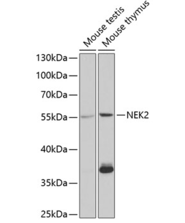 NEK2 Rabbit Polyclonal Antibody