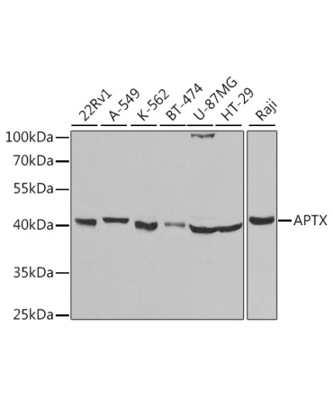 APTX Rabbit Polyclonal Antibody
