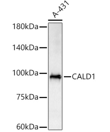 CALD1 Rabbit Polyclonal Antibody
