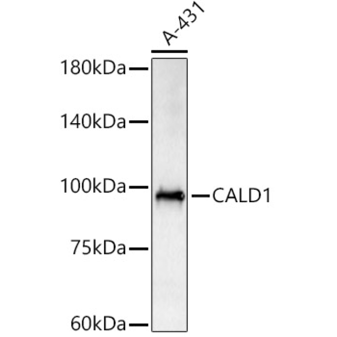 CALD1 Rabbit Polyclonal Antibody