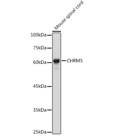 CHRM5 Rabbit Polyclonal Antibody