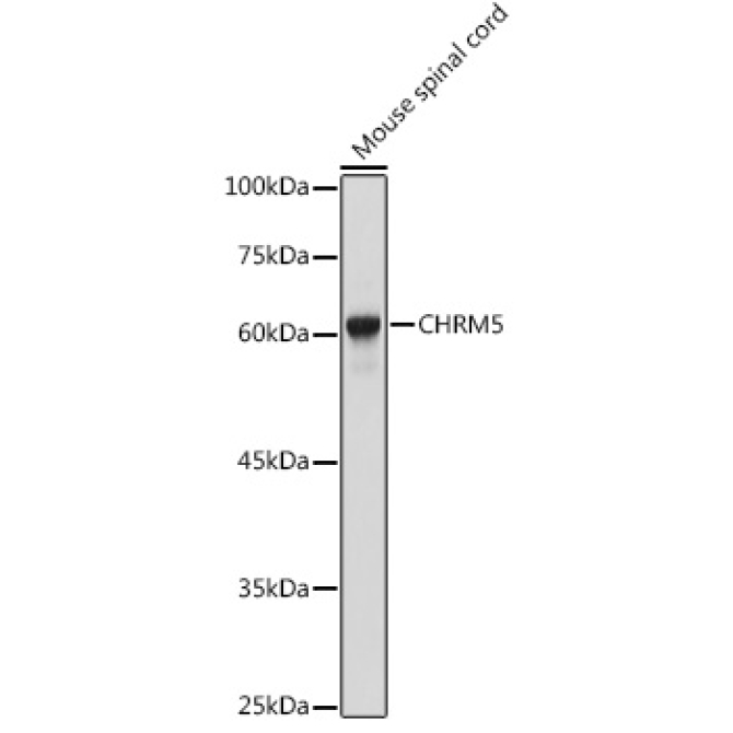 CHRM5 Rabbit Polyclonal Antibody