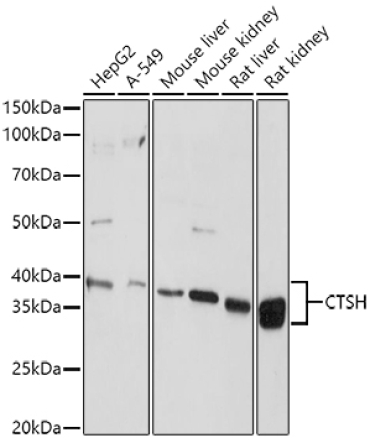CTSH Rabbit Polyclonal Antibody