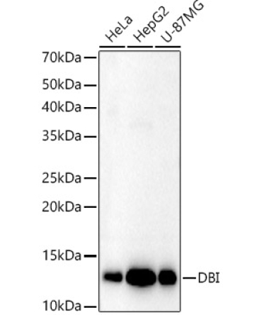 DBI Rabbit Polyclonal Antibody